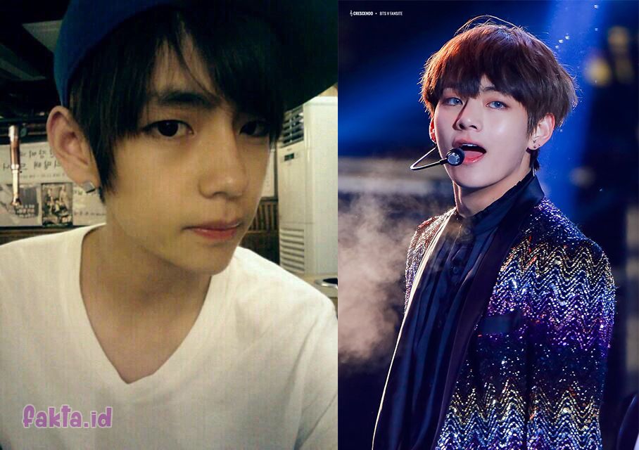 Apakah BTS Operasi Plastik? Fakta, Rumor, dan Perspektif Industri KPop